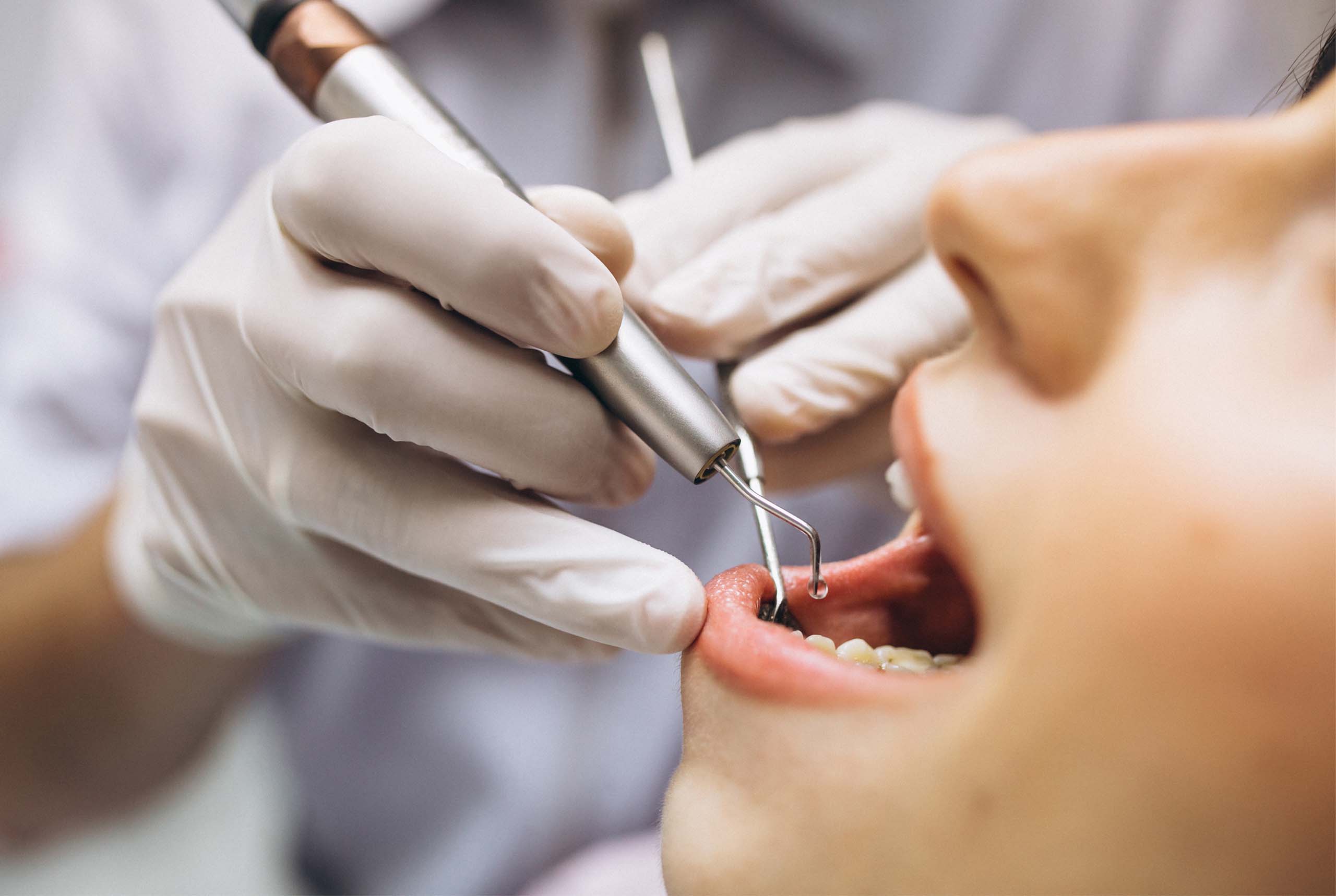 endodontické ošetrenie v dentalpointe